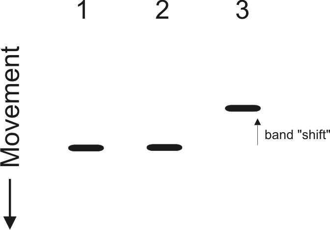 Electrophoretic Mobility Shift Assay