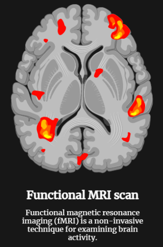 Functional Magnetic Resonance Imaging