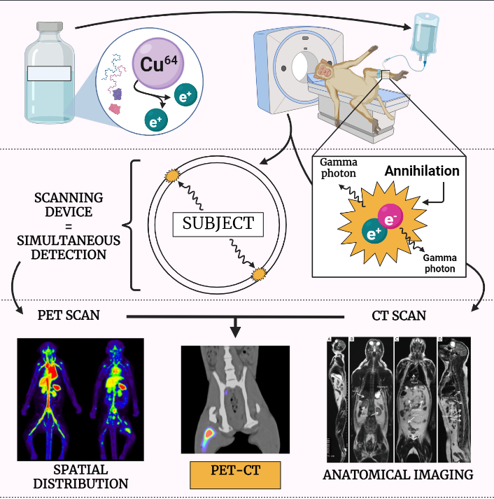 PET (Positron Emission Tomography)