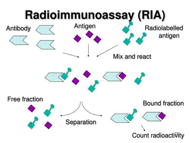 RIA (Radioimmunoassay)