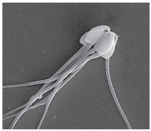 Mammalian Fertilization: Translocation